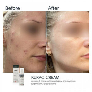 Braderm Kurac Cream